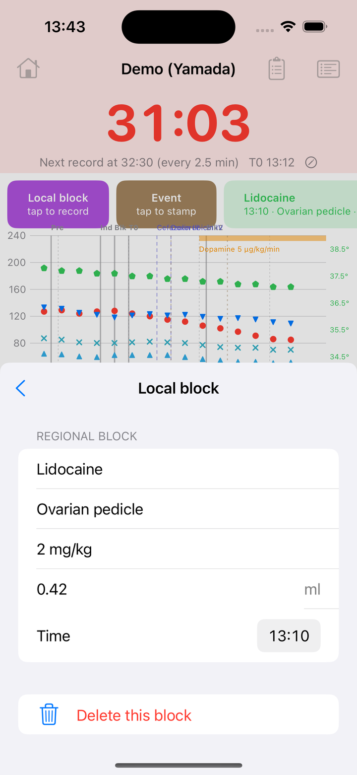Local block シート。REGIONAL BLOCK として Lidocaine、部位 Ovarian pedicle、2 mg/kg、0.42 ml、Time 13:10 が並び、下に Delete this block。